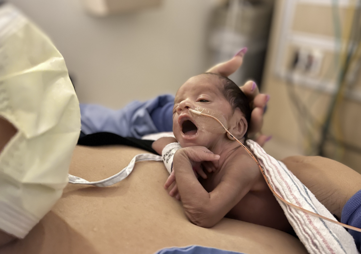 hamil anak kembar, peluang kehamilan kembar, faktor hamil kembar, kehamilan kembar alami, program bayi tabung, risiko kehamilan kembar, Bunda, si Kecil
